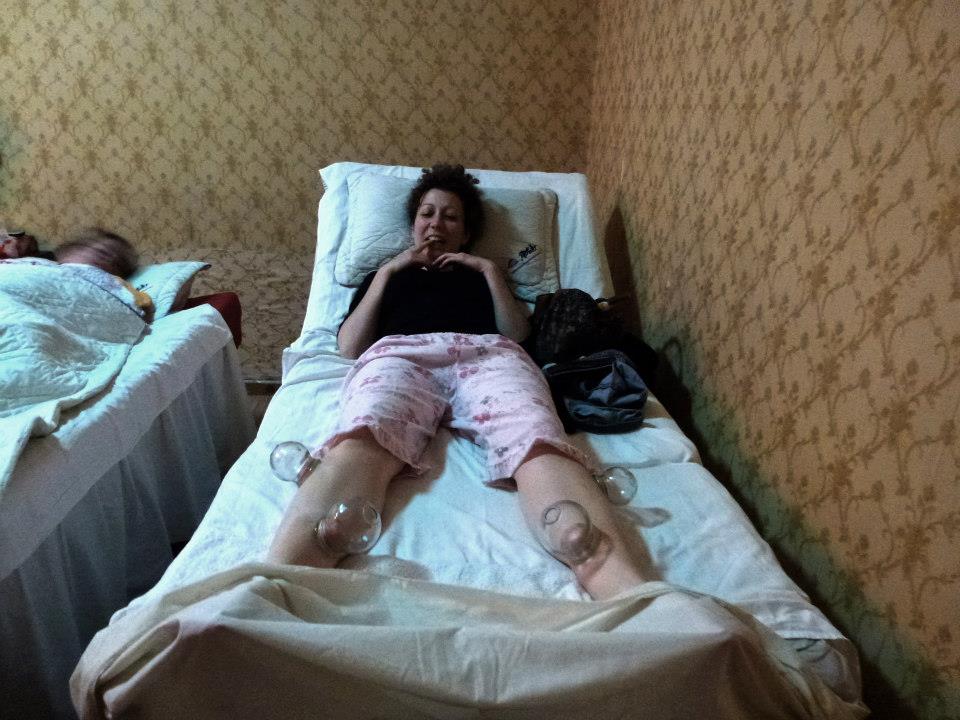 Cupping therapy 3 unusual beijing