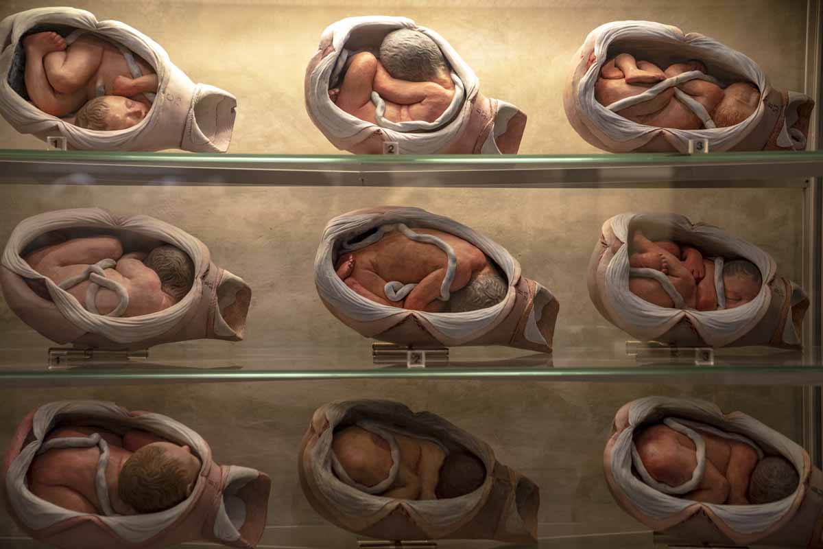 obstetrical casts bologna